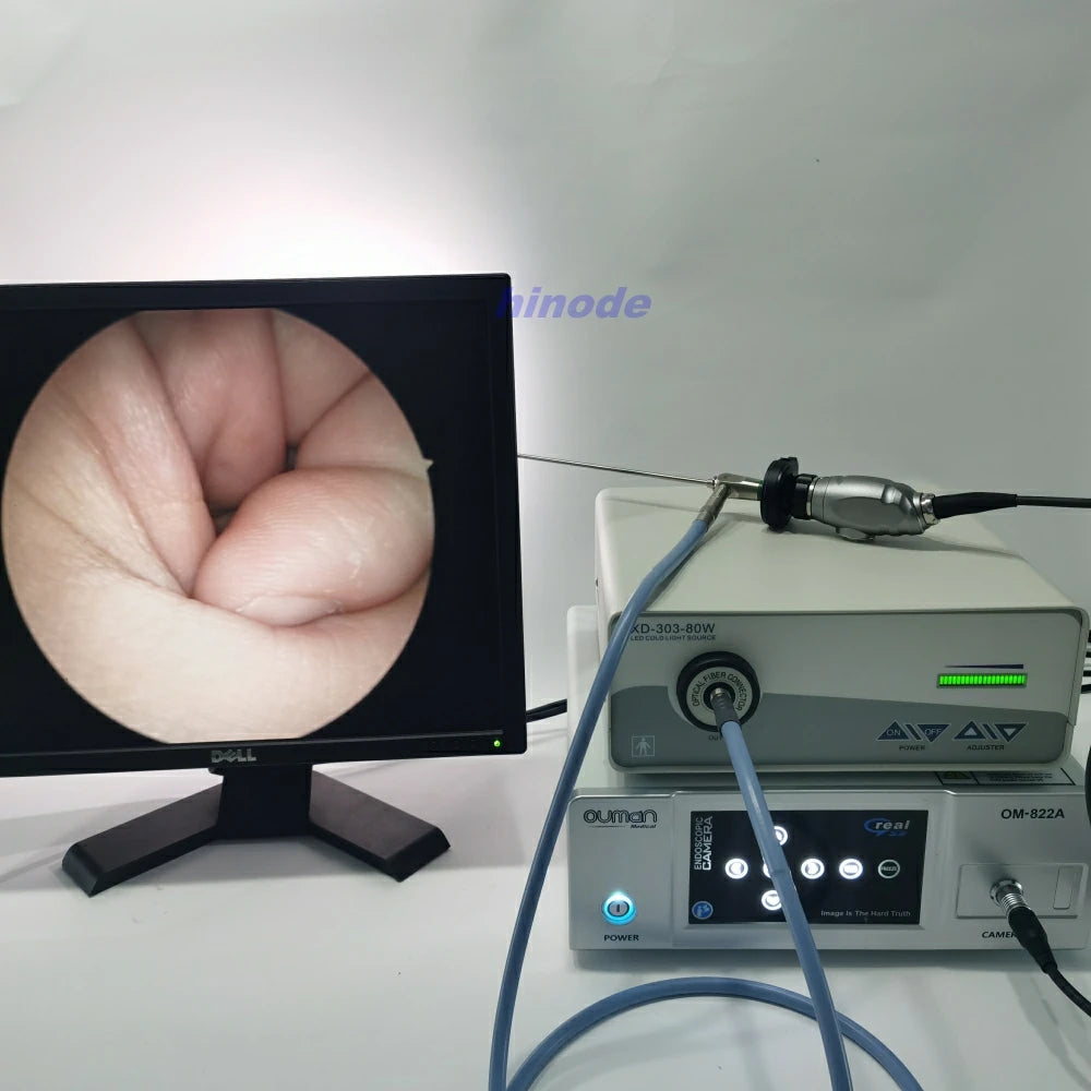 HD Rigid Veterinary Endoscope - 2.7mm/3mm/4mm Multi-Angle Sinuscope for ENT & Veterinary Examination