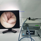 HD Rigid Veterinary Endoscope - 2.7mm/3mm/4mm Multi-Angle Sinuscope for ENT & Veterinary Examination